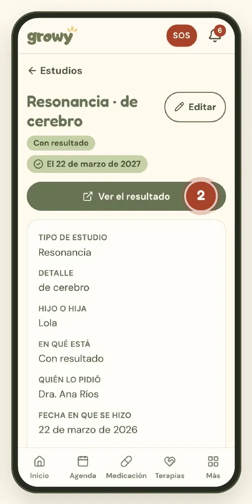 Ficha de un estudio con el botón Ver el resultado